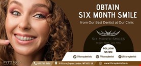 Obtain Six Month Smile from Our Best Dentist at Our Clinic
