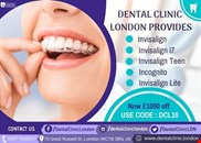 Our Dentist Offers Best Invisalign Deals in London for Your Oral Concerns
