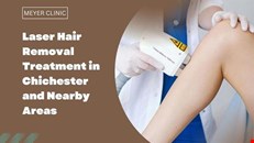 Laser Hair Removal Treatment in Chichester and Nearby Areas