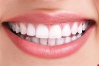 Smile Makeover Dental Clinic in Kerala
